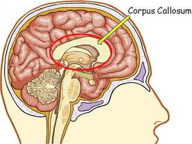 corpus callosum